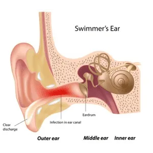 glutathione drops won't stay in my ear How To Prevent & Treat Swimmer's Size:60 Vegetarian Capsules Astrocyte Study Ties Vitamin kojic acid cream