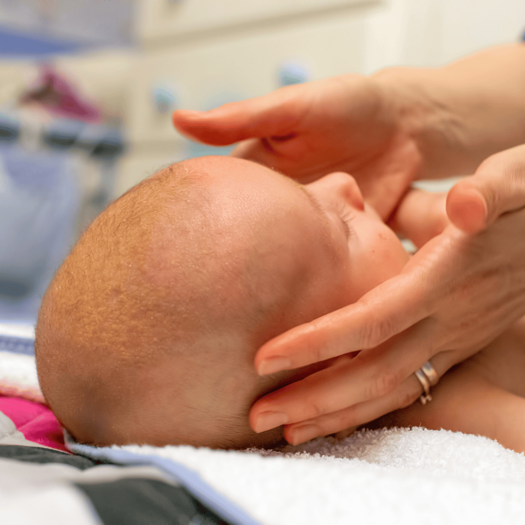 A baby's head that has a common skin condition known as cradle cap.