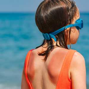 A young girl with a sun burn gazes at the ocean while wearing an orange swimsuit and blue goggles.