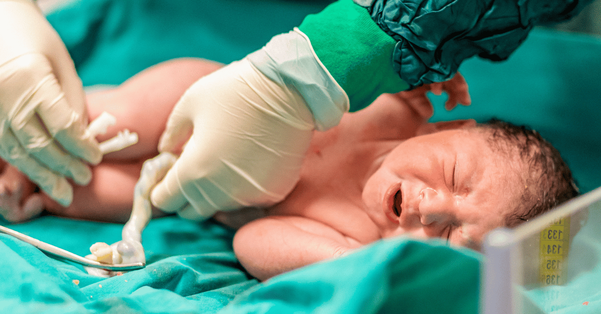 Delayed Umbilical Cord Clamping: The Benefits & Risks