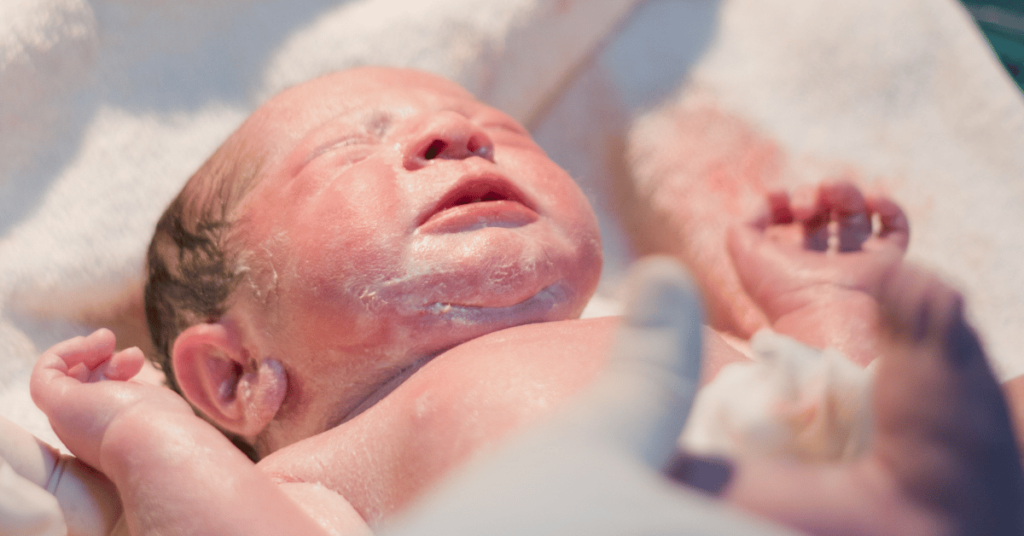 A newborn covered in vernix.