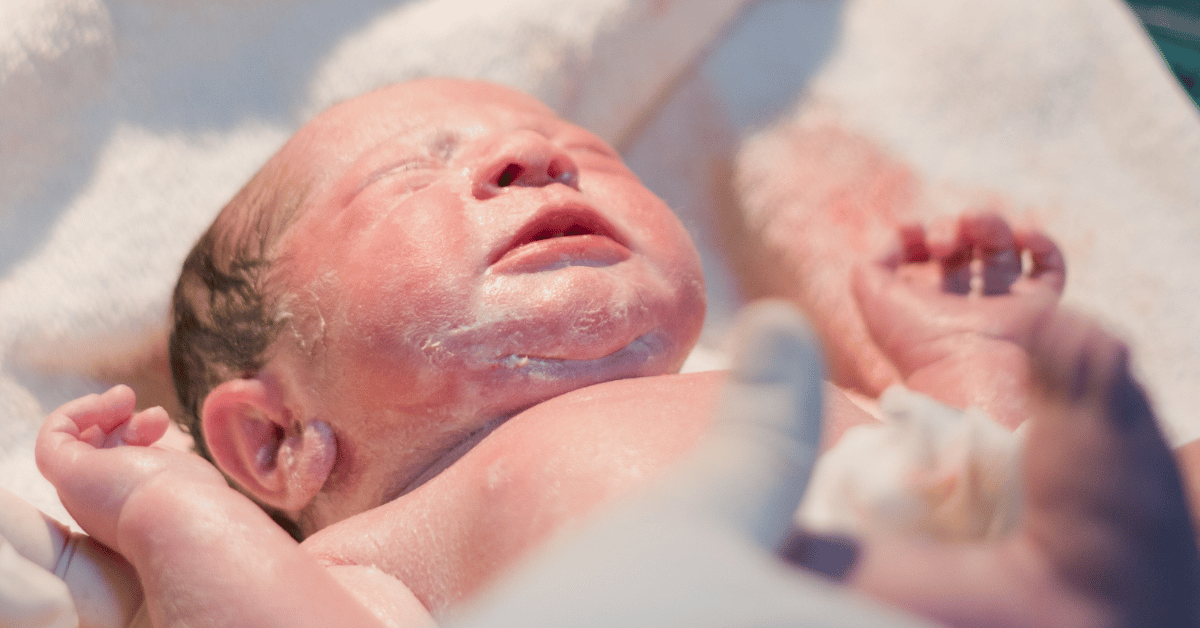 All About Vernix: Should It Be Washed Off?