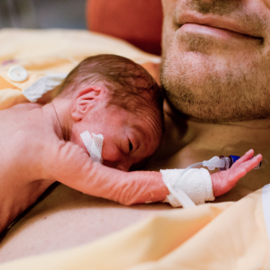 A premature infant lays on a man's bare chest.