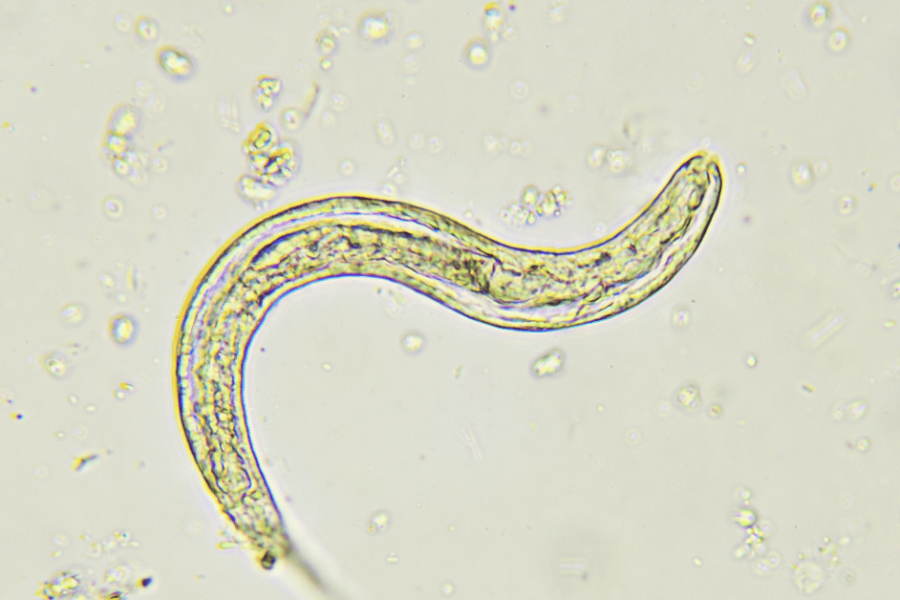 An under the microscope view of a pinworm.