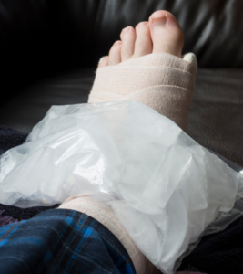 A sprained ankle is elevated, wrapped, and covered in ice. 