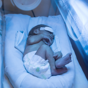 An infant receives phototherapy at a hospital for jaundice.