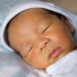 A baby's skin is slightly yellowed from jaundice.