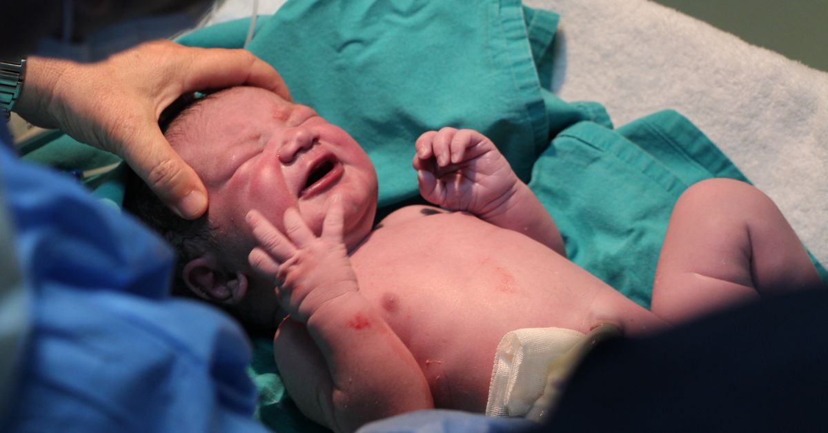 A newborn baby lays in a hospital bassinet immediately after birth.