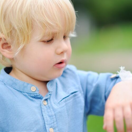 A toddler holds up his sore arm.
