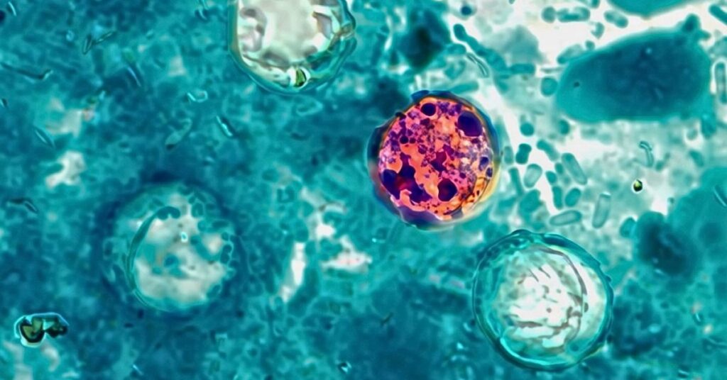A photomicrograph of a fresh stool sample which revealed the presence of four Cyclospora cayetanensis oocysts.