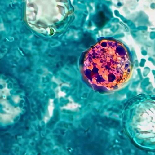 A photomicrograph of a fresh stool sample which revealed the presence of four Cyclospora cayetanensis oocysts.