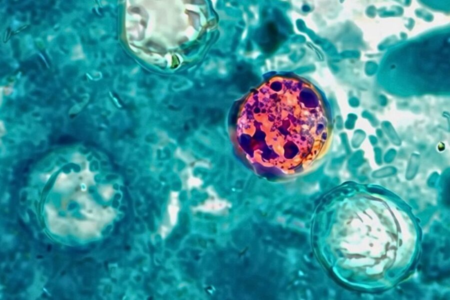 A photomicrograph of a fresh stool sample which revealed the presence of four Cyclospora cayetanensis oocysts.